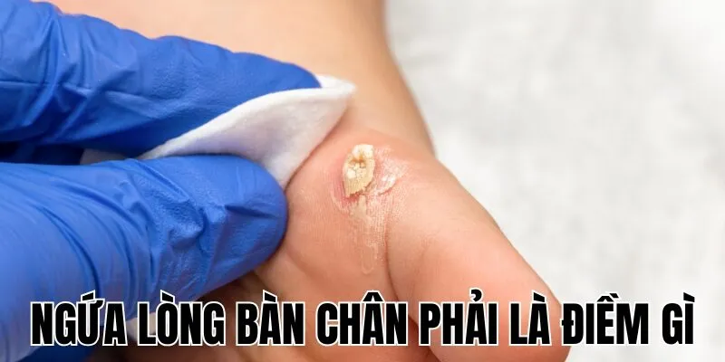 Ngứa Lòng Bàn Chân Phải Là Điềm Gì
